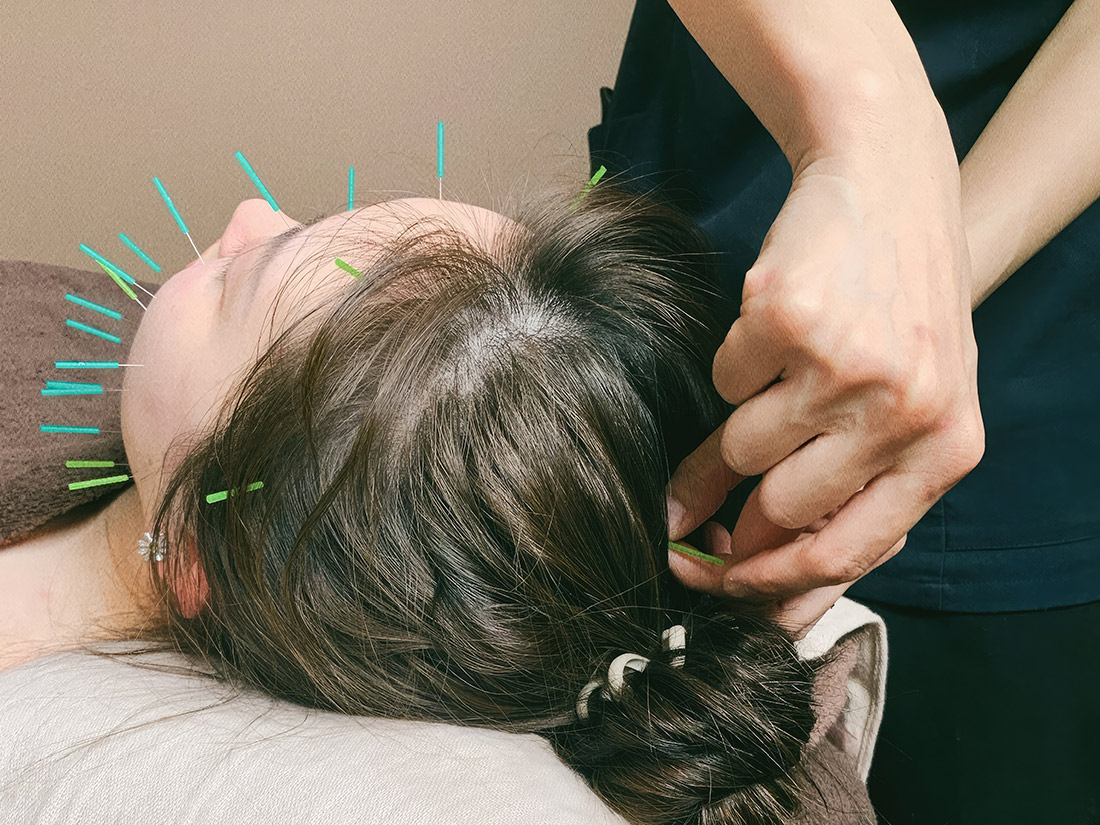 北九州市小倉南区沼緑町の交通事故治療|縁はりきゅう整骨院